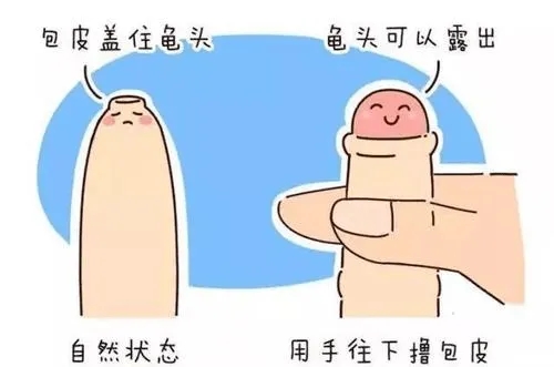 Ƥʲô
