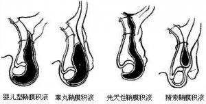 ĤҺЩ?